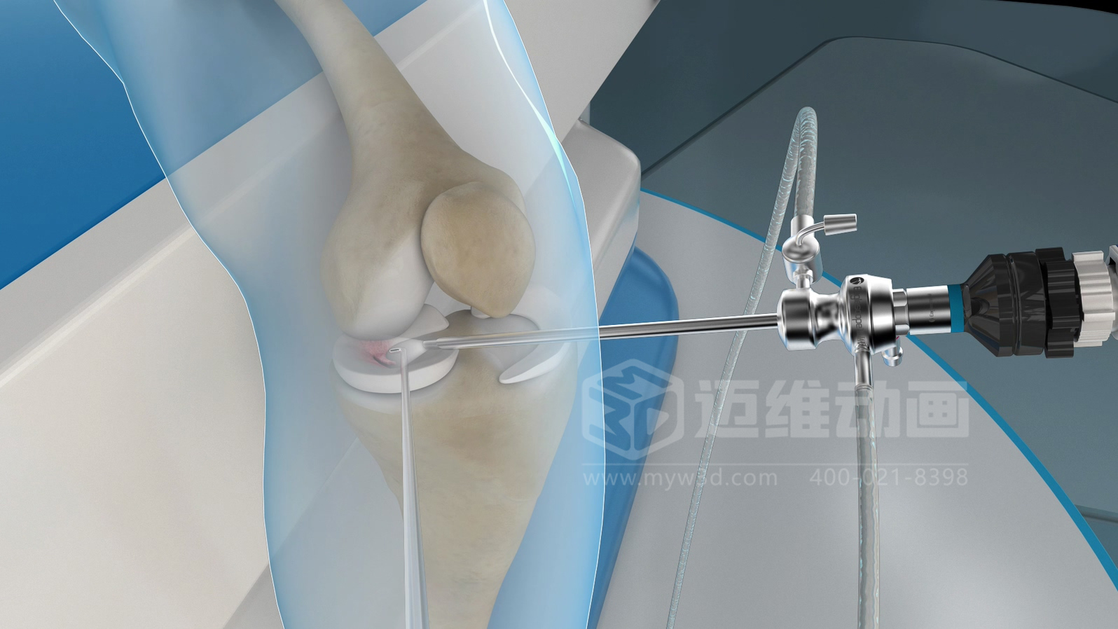 醫學手術三維動畫制作公司哪家好？解碼上海邁維動漫的醫學醫療3D可視化創新之路(圖1)